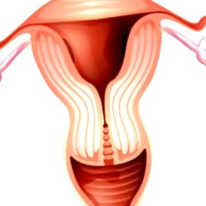 cancer-de-ovario - cancer de ovario causas sintomas y tratamiento 300x300