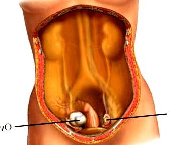 Este artículo ayudará a las mujeres a obtener este conocimiento al explicar en detalle las dos señales de advertencia principales: dolor abdominal e incontinencia urinaria