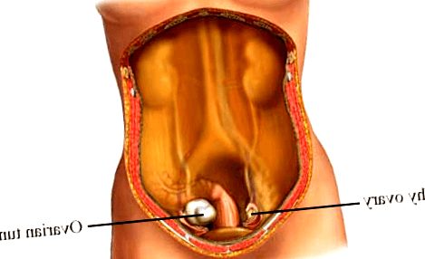 Este artículo ayudará a las mujeres a obtener este conocimiento al explicar en detalle las dos señales de advertencia principales: dolor abdominal e incontinencia urinaria