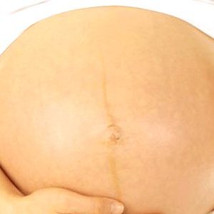 embarazo - probabilidad de embarazo con ovarios poliquisticos 300x300
